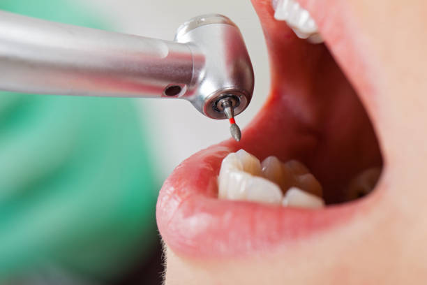 Best Tooth Pain Emergency Relief  in Gardendale, TX